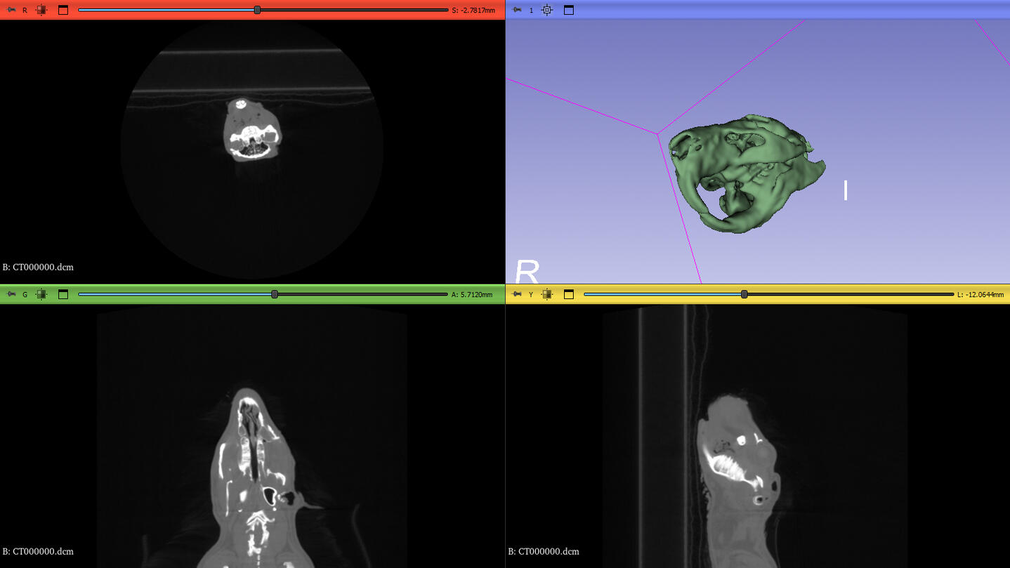 Processed CT scan data into STL format using 3D Slicer, Processed in Zbrush for 3D printing.
